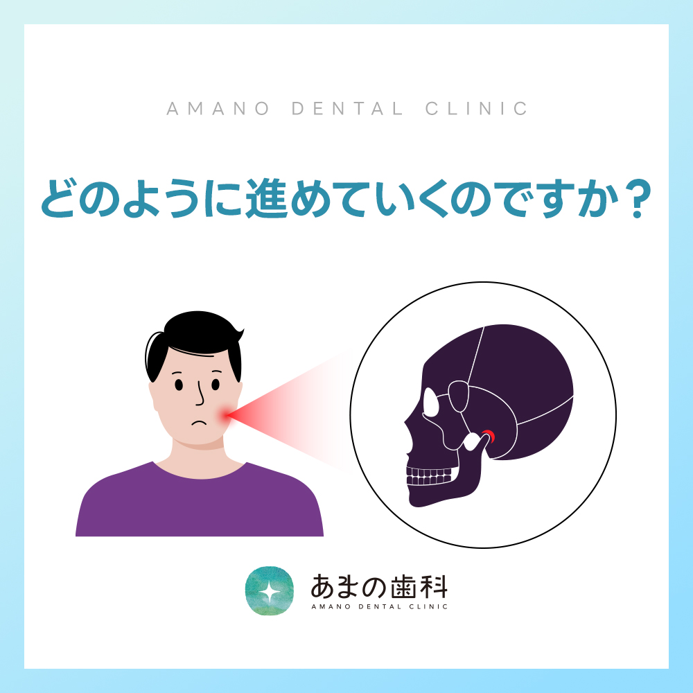 九条ボツリヌス治療