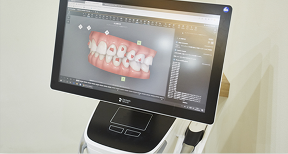 歯科用CTによる精密なインプラント治療計画